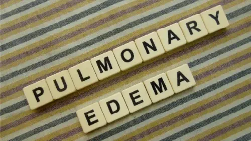 How Do You Treat Pulmonary Edema?